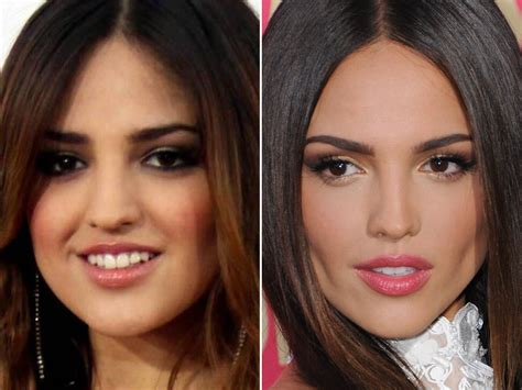 eiza gonzález lips before and after